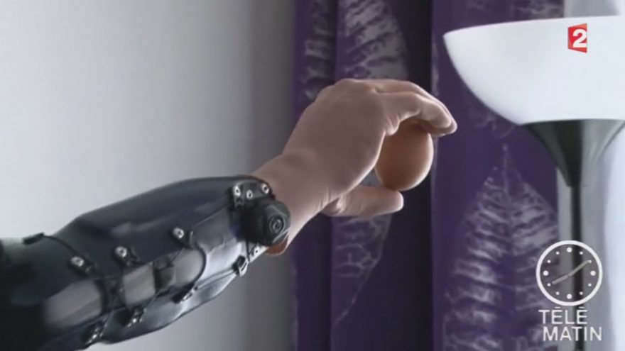 Prothèse bionique : 3 patients autrichiens retrouvent l’usage de leur main amputée