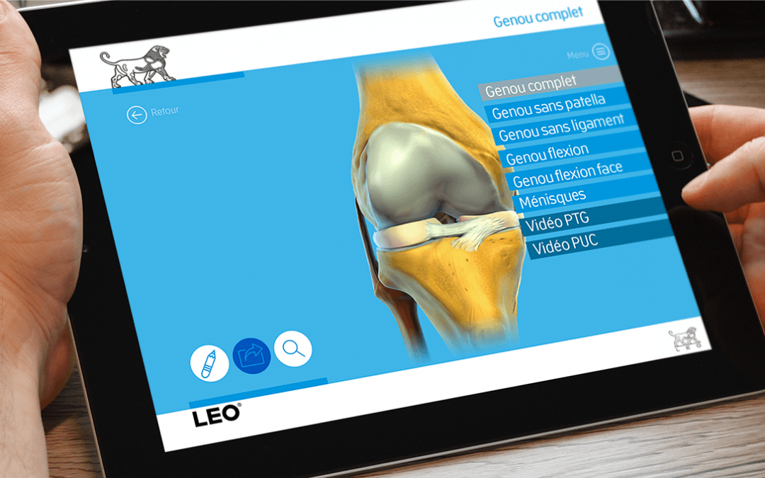 Orthoblok, un outil interactif à destination des orthopédistes.